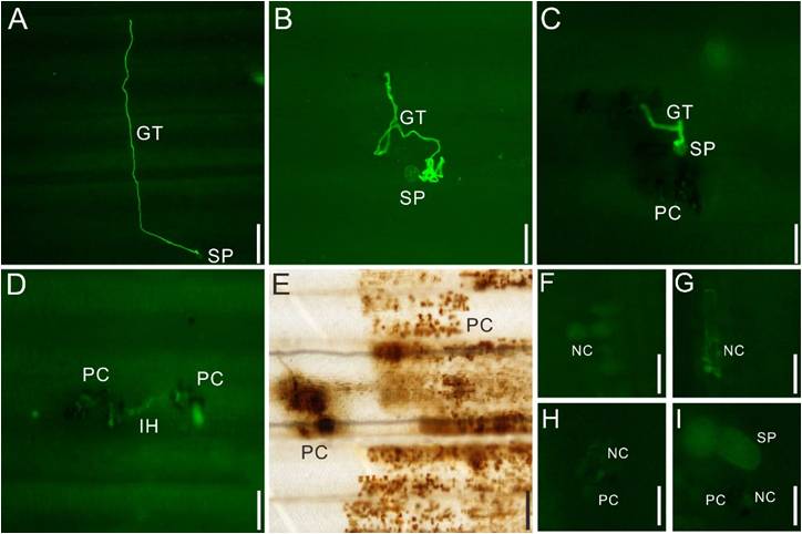 The Brachypodium distachyon-wheat stripe rust as a model pathosystem for studying the nonhost resistance was established by QI Xiaoquan group